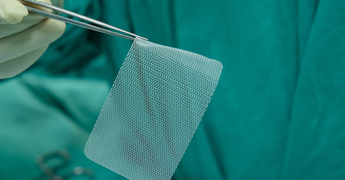 Bard Hernia Mesh Lawsuits Expected to Top 6,000 by 2020