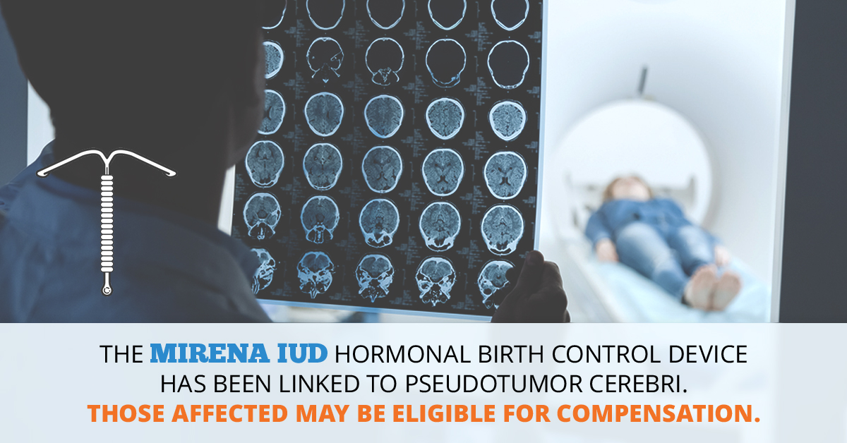 Mirena IUD Pseudotumor Cerebri Lawsuit // Consumer Safety Watch