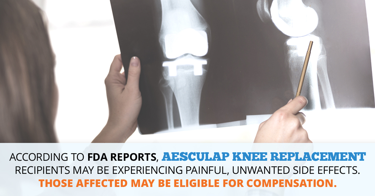 Aesculap Knee Replacement Lawsuit // Consumer Safety Watch