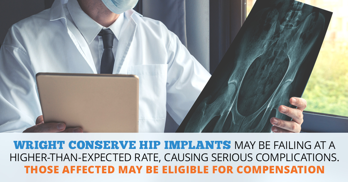 Wright Conserve Hip Lawsuit | Consumer Safety Watch